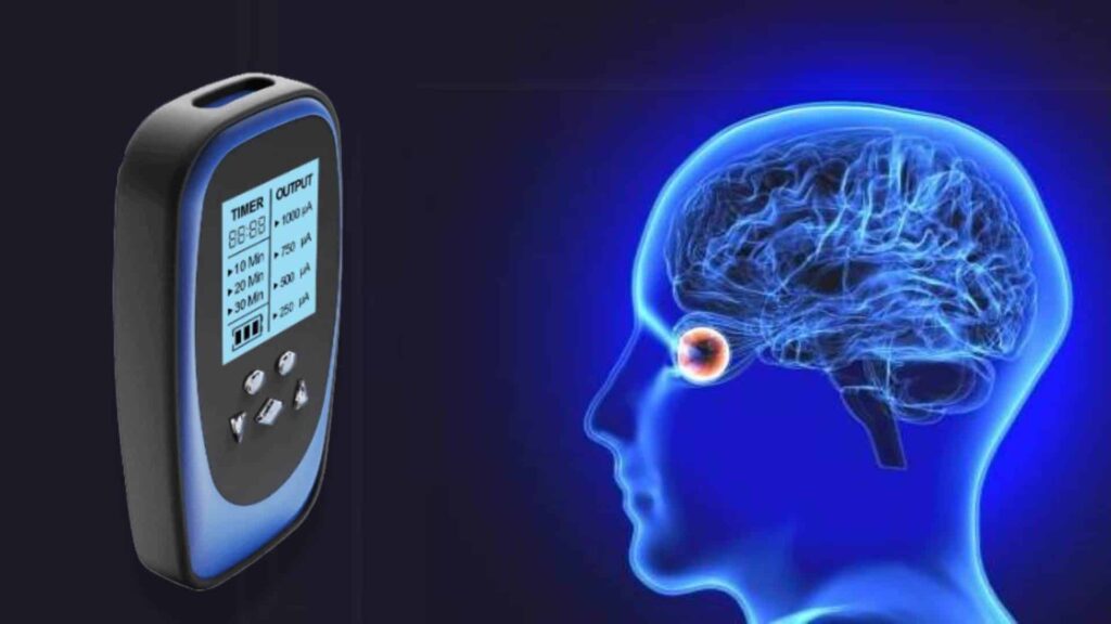 Alternating current stimulation for optic nerve